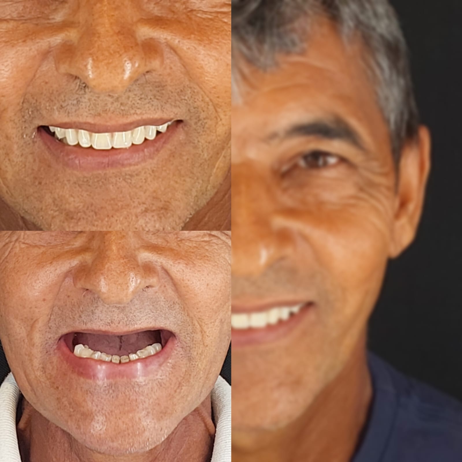 Antes e depois 1
