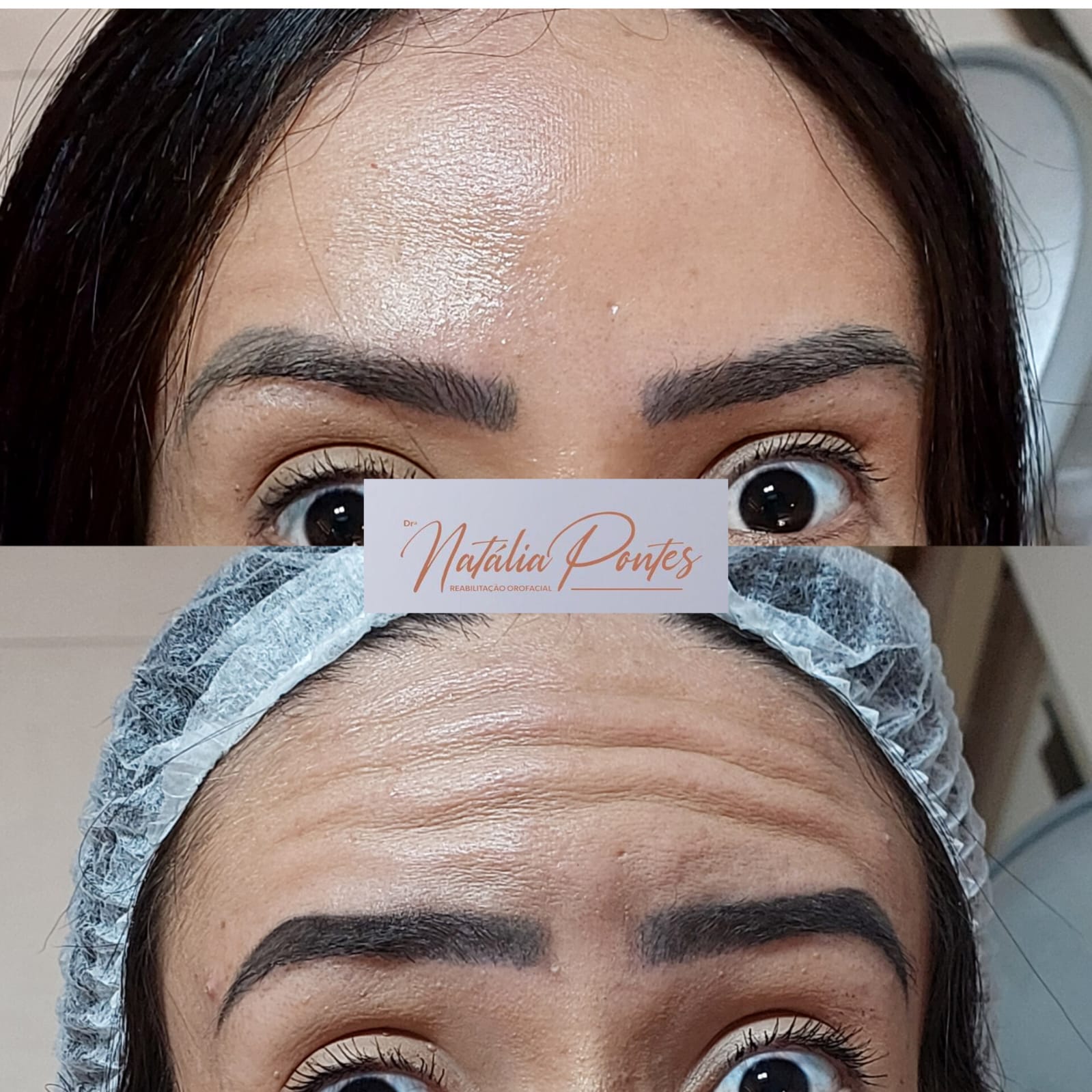 Antes e depois 3