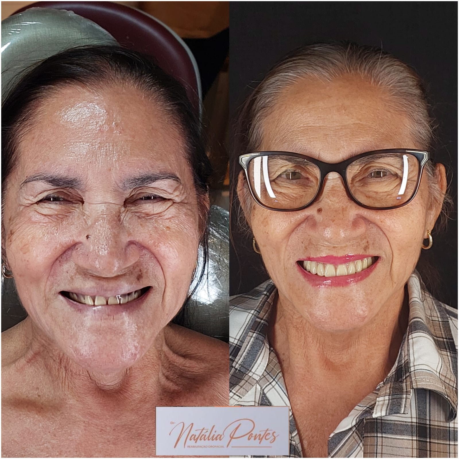 Antes e depois 7